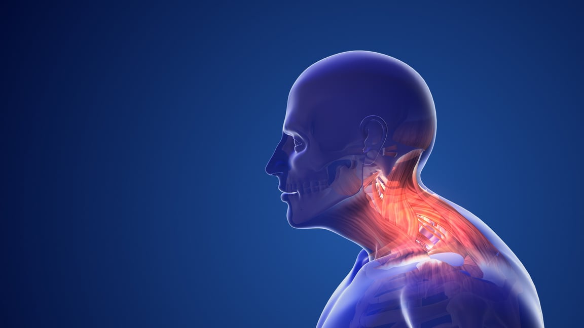 Cervical postural syndrome or neck pain